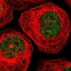 Immunofluorescent staining of human cell line A-431 shows localization to nucleoplasm.