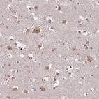 Immunohistochemical staining of human cerebral cortex shows moderate cytoplasmic positivity in neuronal cells.