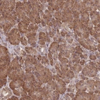 Immunohistochemical staining of human pancreas shows strong cytoplasmic positivity in exocrine glandular cells.