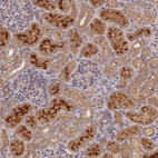 Immunohistochemical staining of human kidney shows strong cytoplasmic and membranous positivity in cells in tubules.