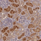 Immunohistochemical staining of human kidney shows strong cytoplasmic and membranous positivity in cells in tubules.