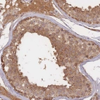 Immunohistochemical staining of human testis shows moderate cytoplasmic and membranous positivity in cells in seminiferous ducts.