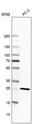 Western blot analysis in human cell line PC-3.