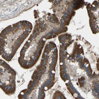 Immunohistochemical staining of human duodenum shows strong membranous and cytoplasmic positivity in glandular cells.