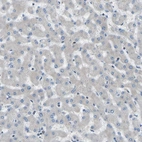 Immunohistochemical staining of human liver shows no membranous positivity in hepatocytes as expected.