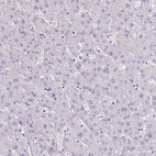 Immunohistochemical staining of human liver shows no positivity in hepatocytes.
