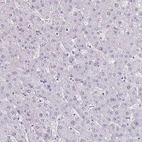 Immunohistochemical staining of human liver shows no positivity in hepatocytes.