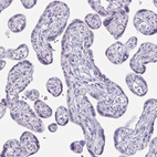 Immunohistochemical staining of human placenta shows no positivity in trophoblastic cells as expected.