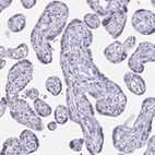 Immunohistochemical staining of human placenta shows no positivity in trophoblastic cells as expected.