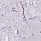 Immunohistochemical staining of human skeletal muscle shows no positivity in myocytes as expected.