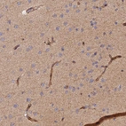 Immunohistochemical staining of human cerebral cortex shows moderate cytoplasmic positivity in neuropil and endothelial cells.