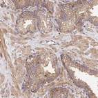 Immunohistochemical staining of human prostate shows moderate membranous/cytoplasmic-membranous positivity in glandular cells and smooth muscle cells.
