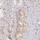 Immunohistochemical staining of human testis shows moderate cytoplasmic positivity in cells in seminiferous ducts.