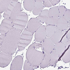 Immunohistochemical staining of human skeletal muscle shows no positivity in myocytes as expected.