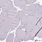 Immunohistochemical staining of human skeletal muscle shows no positivity in myocytes as expected.