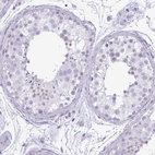 Immunohistochemical staining of human testis shows no positivity in cells in seminiferous ducts as expected.