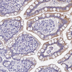 Immunohistochemical staining of human gastrointestinal shows moderate cytoplasmic positivity in glandular cells.