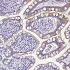 Immunohistochemical staining of human gastrointestinal shows moderate cytoplasmic positivity in glandular cells.