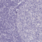 Immunohistochemical staining of human lymphoid tissues shows no positivity in non-germinal center and germinal center cells as expected.