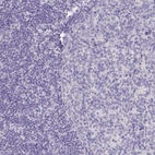 Immunohistochemical staining of human lymphoid tissues shows no positivity in non-germinal center and germinal center cells as expected.