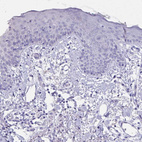 Immunohistochemical staining of human skin shows no positivity in squamous epithelial cells as expected.