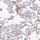 Immunohistochemical staining of human lung shows moderate cytoplasmic positivity in macrophages.