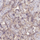 Immunohistochemical staining of human placenta shows moderate cytoplasmic positivity in trophoblastic cells.
