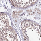 Immunohistochemical staining of human testis shows moderate cytoplasmic positivity in Leydig cells and cells in seminiferous ducts.