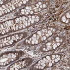 Immunohistochemical staining of human rectum shows strong cytoplasmic positivity in glandular cells and lymphoid cells.