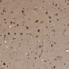 Immunohistochemical staining of human cerebral cortex shows strong cytoplasmic positivity in neurons and neuropil.