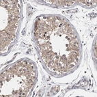 Immunohistochemical staining of human testis shows moderate cytoplasmic positivity in cells in seminiferous ducts.