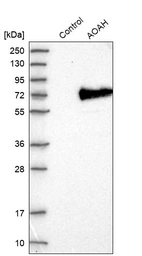 Western blot analysis in control (vector only transfected HEK293T lysate) and AOAH over-expression lysate (Co-expressed with a C-terminal myc-DDK tag (~3.1 kDa) in mammalian HEK293T cells, LY400615).