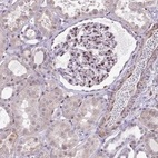 Immunohistochemical staining of human kidney shows moderate nuclear positivity in cells in glomeruli.