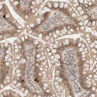 Immunohistochemical staining of human small intestine shows moderate nuclear and cytoplasmic positivity in glandular cells.