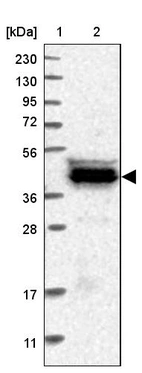 Lane 1: Marker [kDa] 230, 130, 95, 72, 56, 36, 28, 17, 11_br/_Lane 2: Human cell line RT-4
