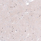 Immunohistochemical staining of human cerebral cortex shows strong nuclear positivity in neurons.