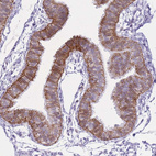 Immunohistochemical staining of human fallopian tube shows strong membranous positivity in glandular cells.