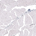 Immunohistochemical staining of human skeletal muscle shows strong nuclear positivity in myocytes.