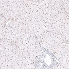 Immunohistochemical staining of human liver shows weak nuclear positivity in hepatocytes.