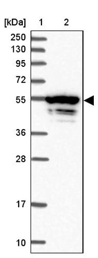 Lane 1: Marker [kDa] 250, 130, 95, 72, 55, 36, 28, 17, 10_br/_Lane 2: Human cell line RT-4