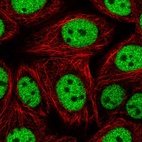 Immunofluorescent staining of human cell line MCF7 shows localization to nucleoplasm.