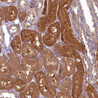 Immunohistochemical staining of human kidney shows strong cytoplasmic positivity in cells in tubules.