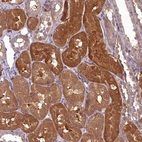 Immunohistochemical staining of human kidney shows strong cytoplasmic positivity in cells in tubules.