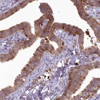 Immunohistochemical staining of human fallopian tube shows moderate cytoplasmic positivity in glandular cells.