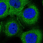Immunofluorescent staining of human cell line A-431 shows localization to cytosol.