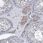 Immunohistochemical staining of human testis shows moderate cytoplasmic positivity in Leydig cells.