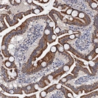 Immunohistochemical staining of human gastrointestinal shows strong cytoplasmic positivity in glandular cells.