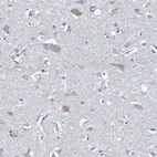 Immunohistochemical staining of human cerebral cortex shows weak cytoplasmic positivity in neurons.