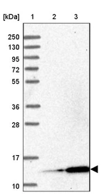Lane 1: Marker [kDa] 250, 130, 95, 72, 55, 36, 28, 17, 10_br/_Lane 2: Human cell line RT-4_br/_Lane 3: Human cell line U-251MG sp