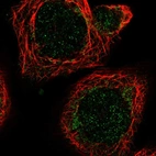 Immunofluorescent staining of human cell line A-431 shows localization to mitochondria.